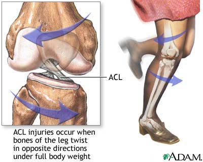 image acl diagram